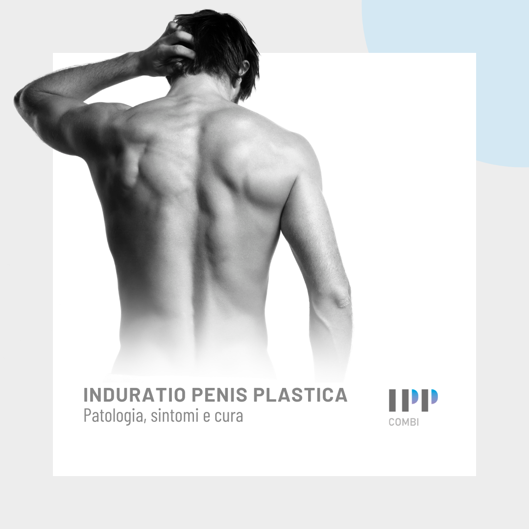 induratio penis plastica