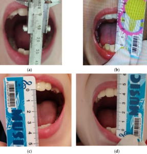 oral mdpi